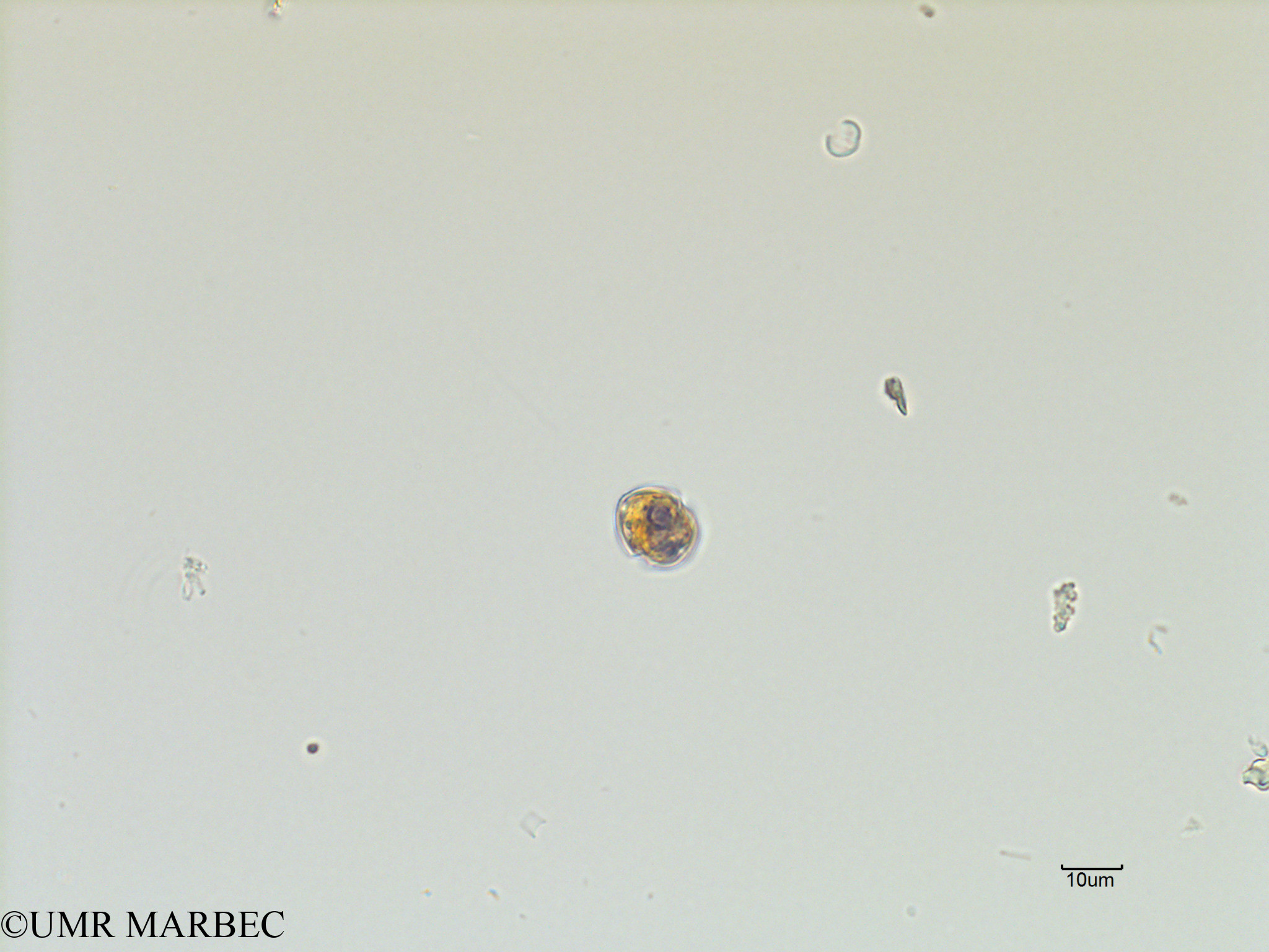 phyto/Scattered_Islands/iles_glorieuses/SIREME November 2015/Scrippsiella spp (SIREME-Glorieuses2015-ech1-171116-Scrippsiella-11)(copy).jpg